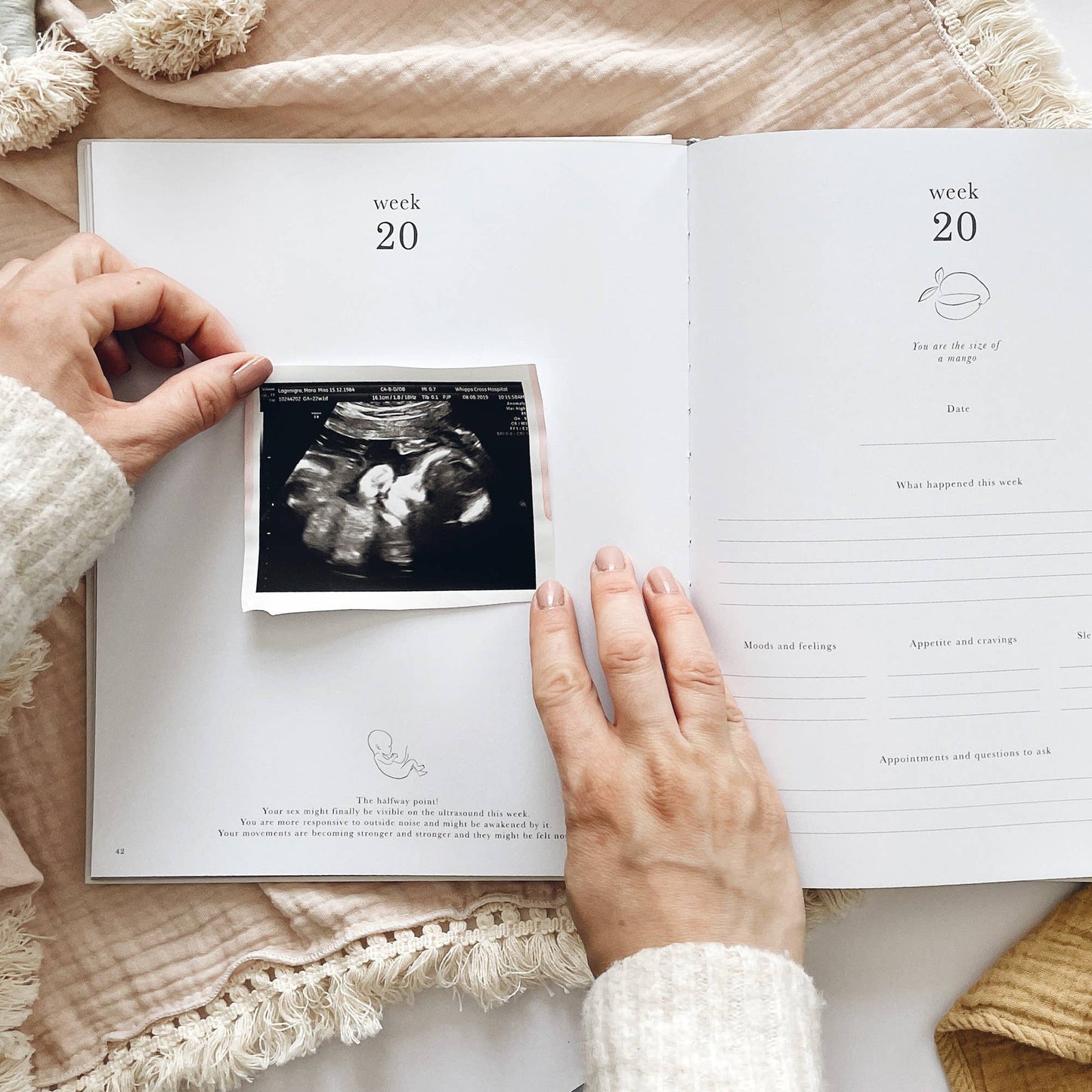 Pregnancy Journal (Animals) expectant mum, parents to be